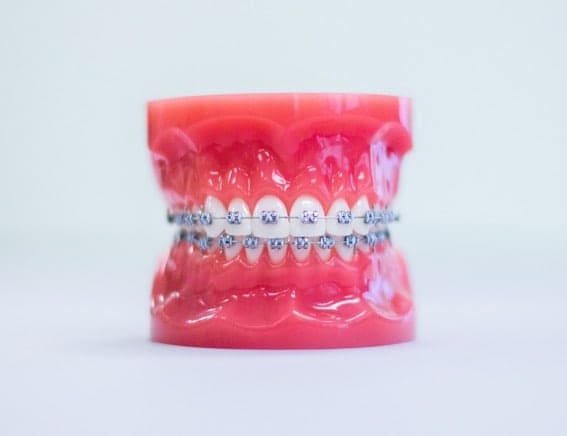 mequon metal braces