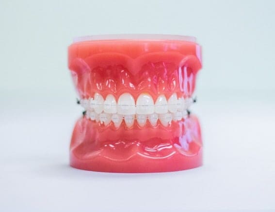 mequon clear braces