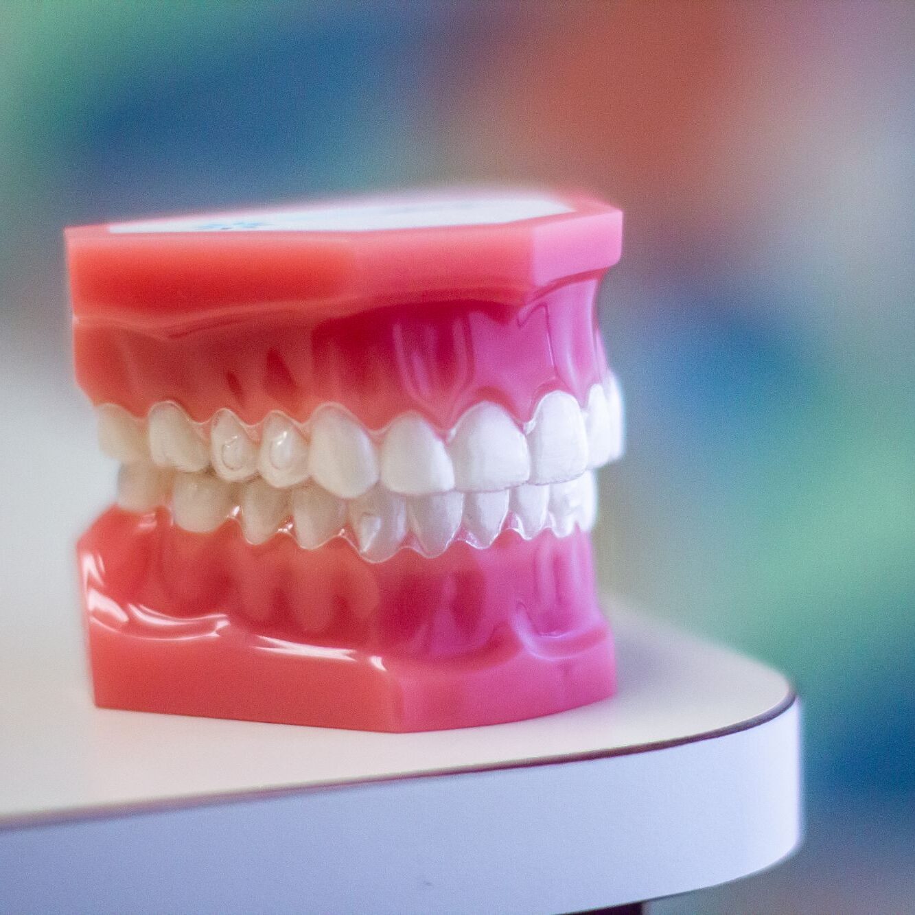 Model of teeth and gums demonstrating clear aligners at Kittleson Orthodontics, highlighting orthodontic treatment options in Mequon.